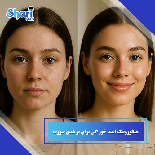 هیالورونیک اسید خوراکی برای پر شدن صورت | 3 مزیت مهم